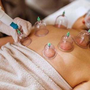 Woman Placing Glass Cups On A Man's Back